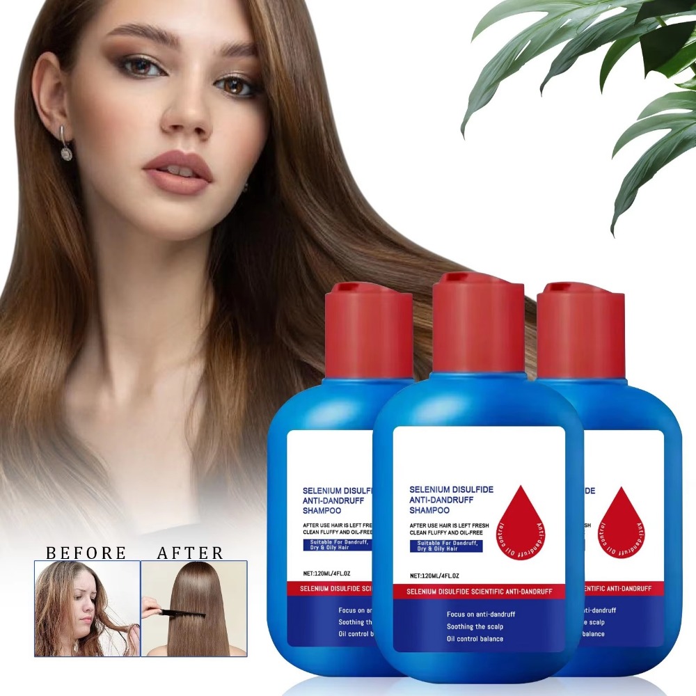 Hair Care Dandruff - Novo Shampoo Nipori 120ml Controle de