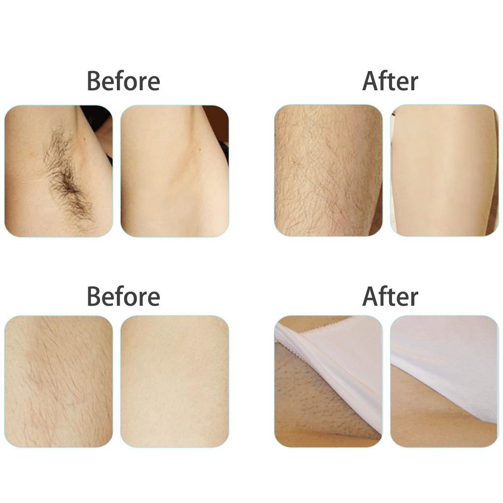 Escova Massageadora de Couro C - Hair Care Dandruff avaliação e preço