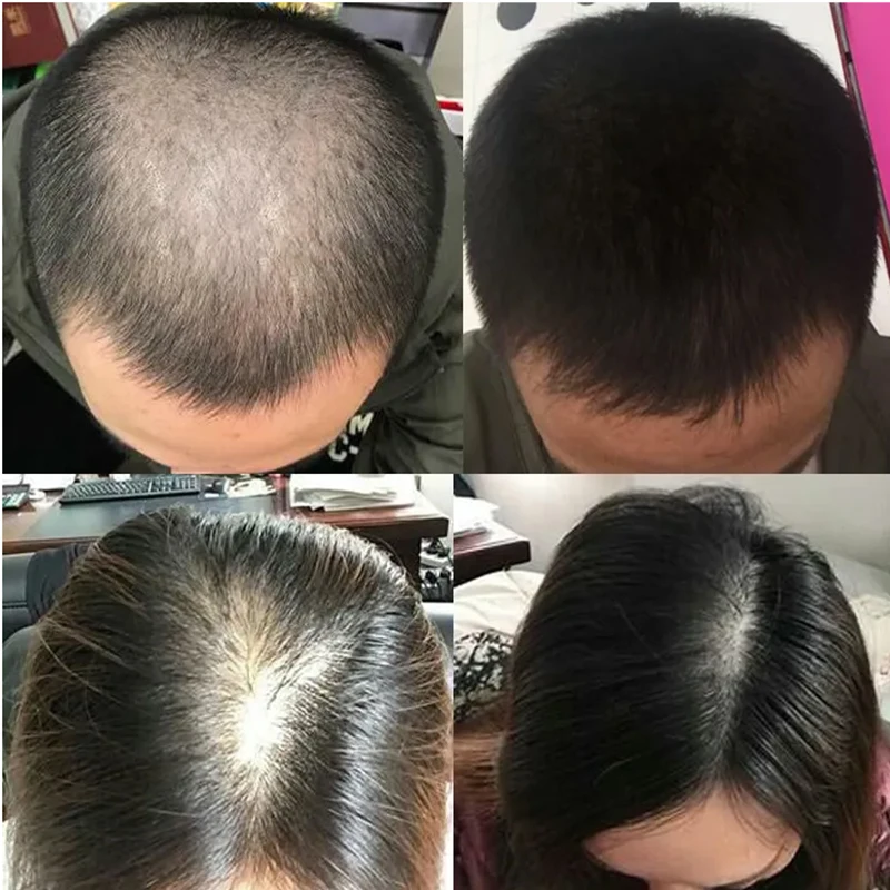 Líquido para Crescimento Capil - Hair Care Or Haircare avaliação e preço
