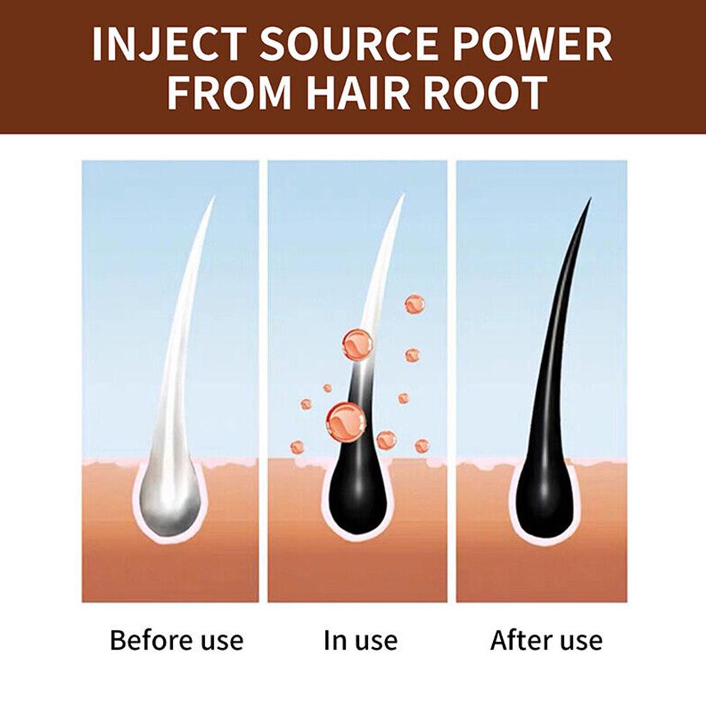 Sabonete Artesanal Natural de  - Hair Care Dandruff avaliação e preço