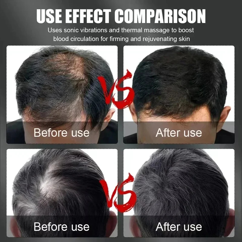 Boné Terapêutico de Luz Vermel - Hair Care For Hair Growth avaliação e preço